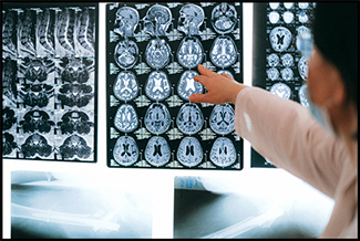 Neurosurgery Nursing Assignment